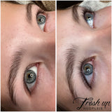 Vippeløft før og etter bilde