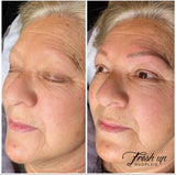 Rekonstruksjon av bryn som mangler hår, med permanent makeup, pmu