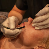 Elektrolyse permanent hårfjerning med strøm. Utføres i ansikt. Diatermi, couperose